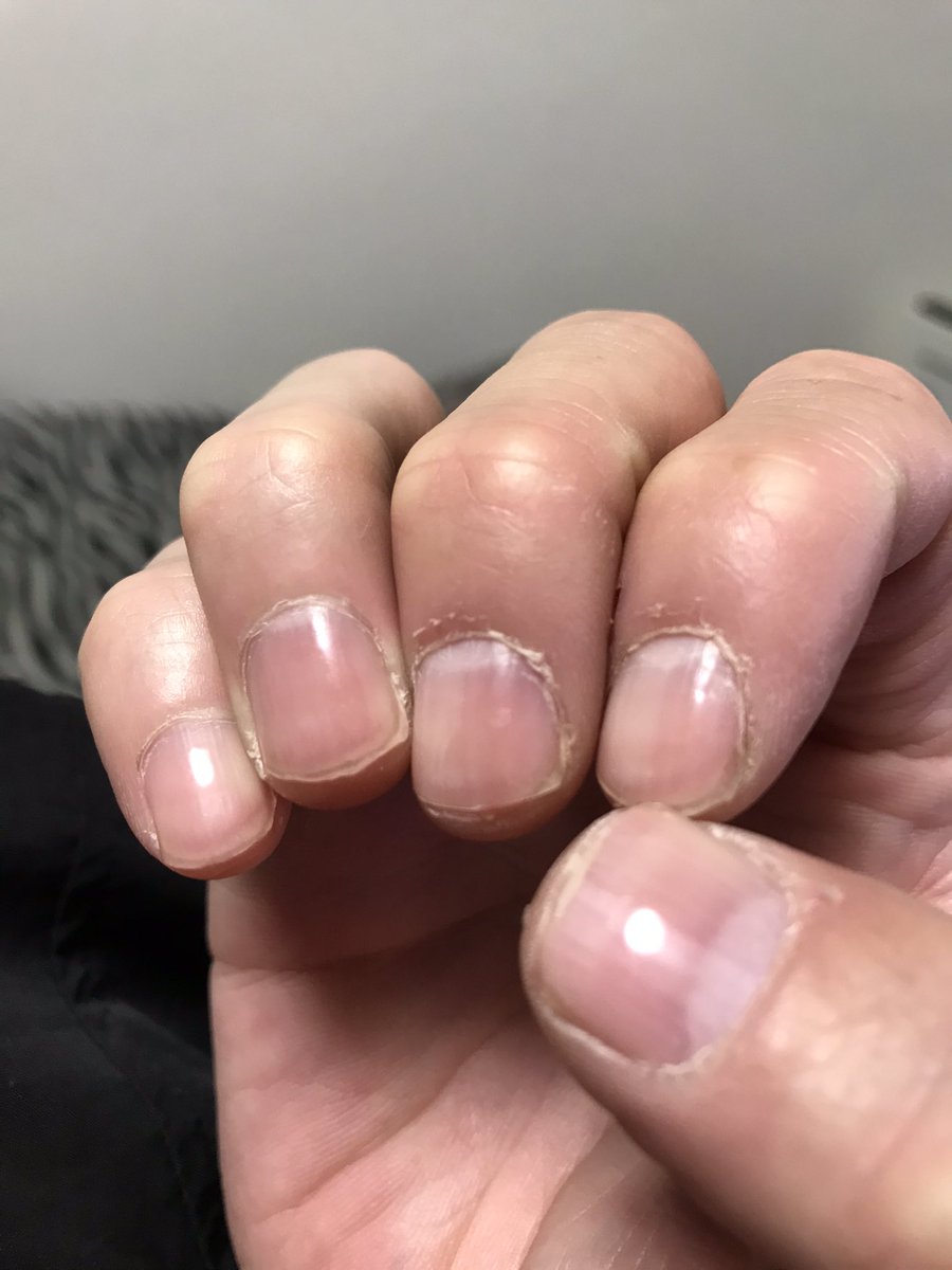 隠す クラシカル トイレ 爪 磨き すぎ Salon Chouchou Jp