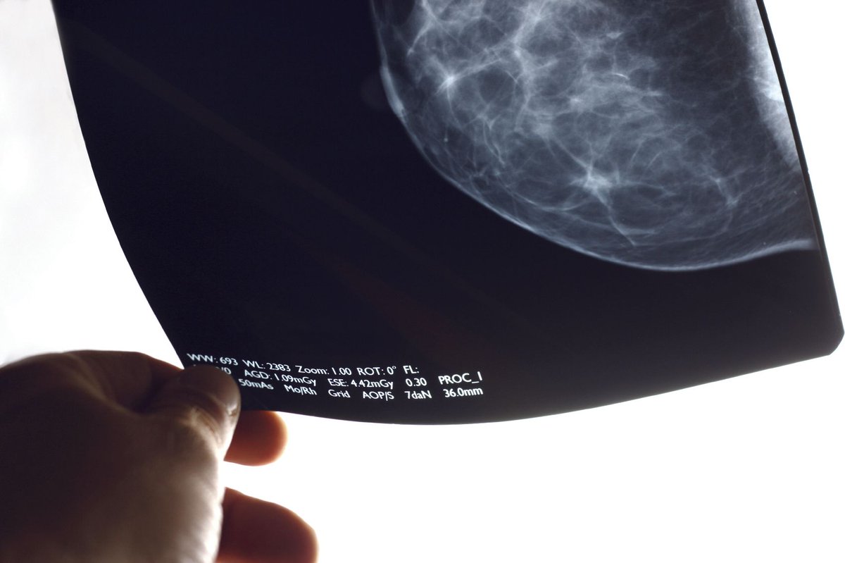 MammoScreen AI Tool Improves Diagnostic Performance of Radiologists in Detecting Breast Cancer - Cancer Network: MammoScreen AI Tool Improves Diagnostic Performance of Radiologists in Detecting Breast Cancer … dlvr.it/RnnZCn #AI #artificialintelligence #Finperform