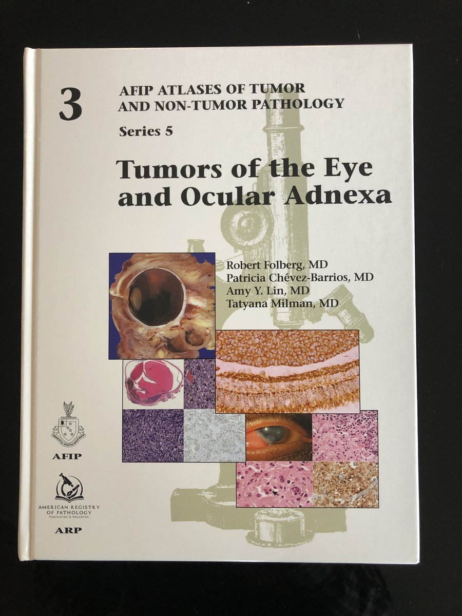 My coauthors and I hope that this book will help pathologists to guide ocular oncologists to preserve life and sight. Details on availability to follow …