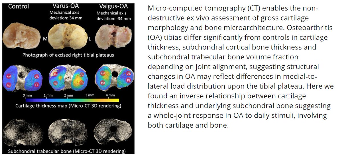 Brittany Wilson (@britmwils) on Twitter photo Inverse relationship of tibial cartilage thickness and subchondral bone plate in human OA assessed by uCT. Check out this new work by <a href="/ORSsociety/">Orthopaedic Research Society</a> members <a href="/SophieRapagna/">Sophie Rapagna</a> @BryantRobertsAU <a href="/EgonPerilli/">Egon Perilli</a>
#JOR full-text: onlinelibrary.wiley.com/doi/10.1002/jo…
#ORSSMC #OrthoTwitter #OrthoResearch Inverse relationship of tibial cartilage thickness and subchondral bone plate in human OA assessed by uCT. Check out this new work by <a href="/ORSsociety/">Orthopaedic Research Society</a> members <a href="/SophieRapagna/">Sophie Rapagna</a> @BryantRobertsAU <a href="/EgonPerilli/">Egon Perilli</a>
#JOR full-text: onlinelibrary.wiley.com/doi/10.1002/jo…
#ORSSMC #OrthoTwitter #OrthoResearch
