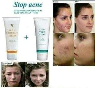 مجموعه التفتيح الامريكيه🌝

تقضي ع التصبغات
اثار الحبوب 💆الكلف والنمش البقع السوداء