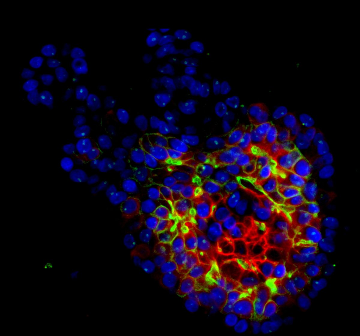 Co_Biologists's tweet photo. Is that 🎅 flying through the sky? Well, he will be later! But for now, we're celebrating day 24 of #BiologistsAdvent with this soaring immunofluorescent staining of human salivary gland organoids from @DMM_Journal. https://t.co/BIn3JW4E5Z