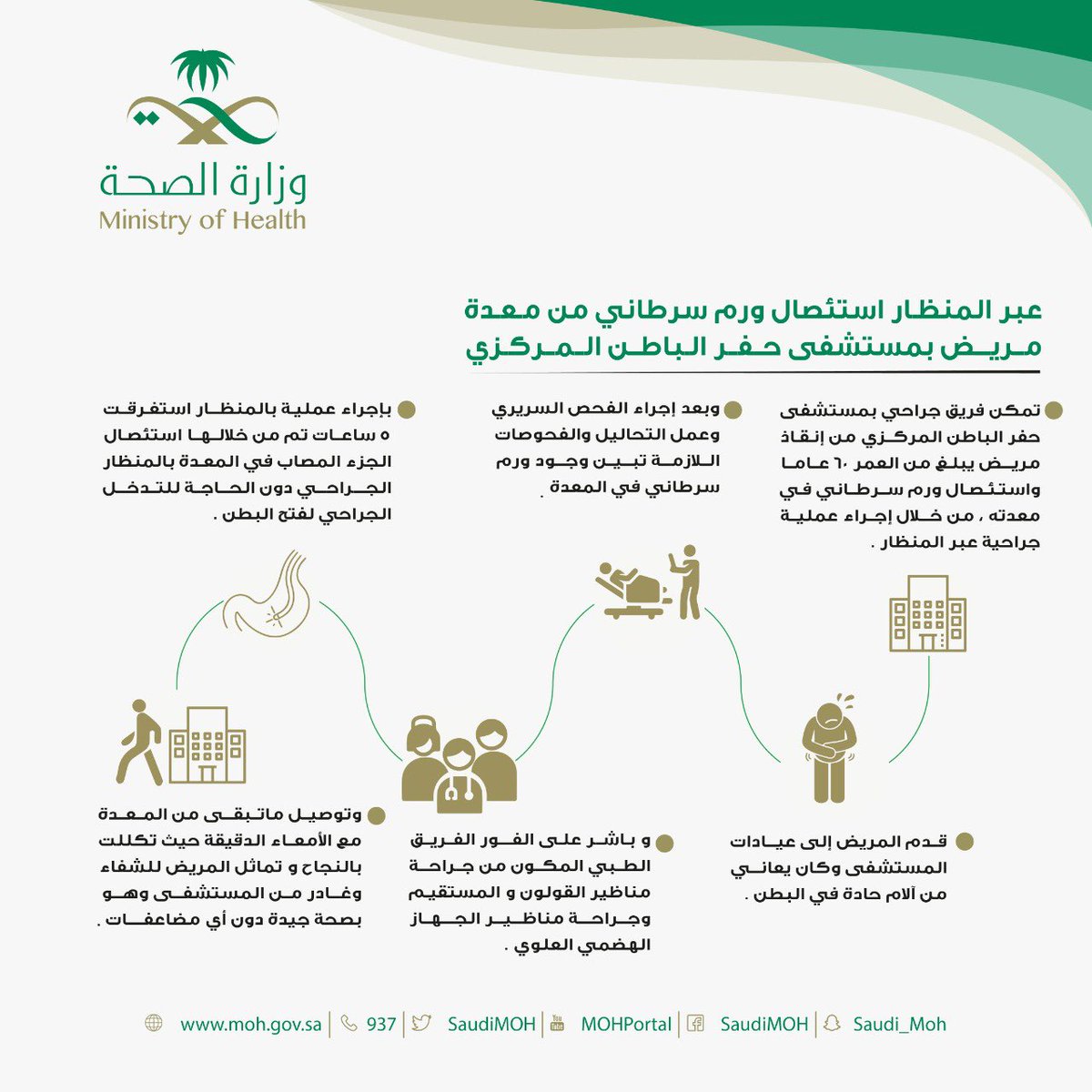 نجاح إستئصال ورم سرطاني من معدة مريض بإستخدام المنظار في #مستشفى_حفر_الباطن_المركزي