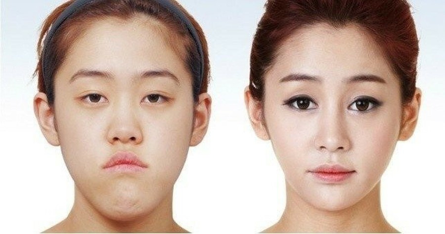 韓流ツイッター בטוויטר 美容整形番組 Let美人 で史上最高といわれる整形に成功したホ イェウンさん 8年後の近況が韓国で話題 整形 当時歳 整形して男性の態度が変わった 韓国は つづき T Co Ajmubajrjg 速報ランキング T Co