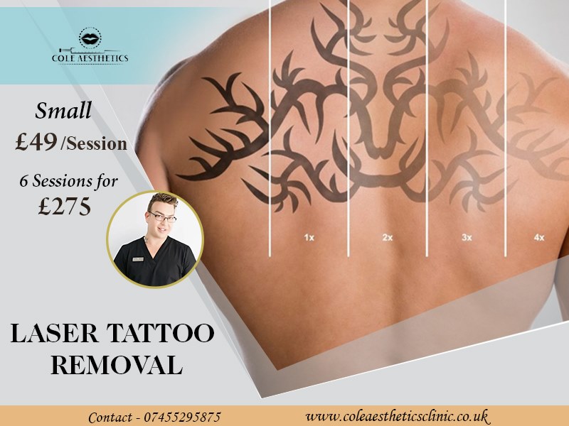 AestheticsCole's tweet photo. We can treat multiple types of tattoos including professional and amateur tattoos in black or colour inks, as well as semi-permanent eye make-up, and is suitable for all skin types.
https://t.co/qbDdzQjaLA
#ColeAesthetics #Tattoo #LaserTattooRemoval #TattooRemoval #Tattoos https://t.co/B9Fb1wvfCv
