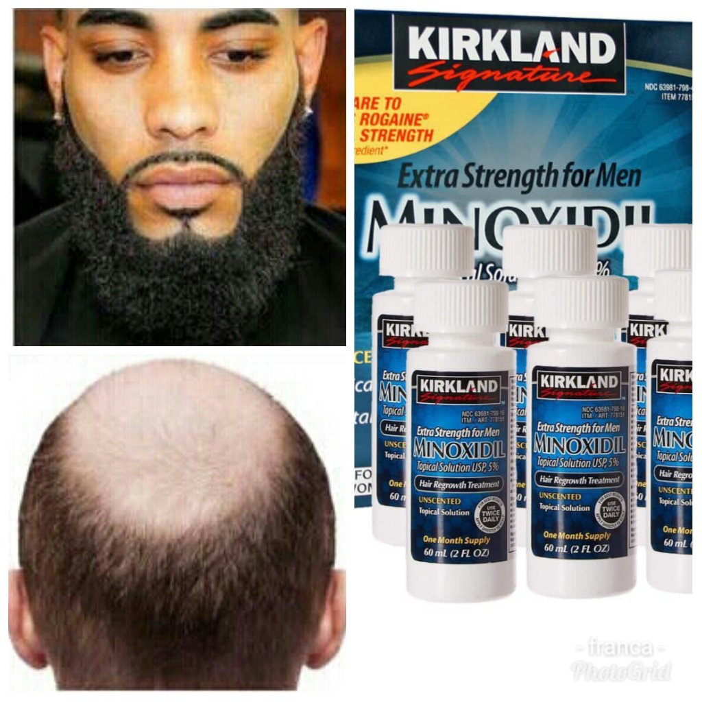Foster Fos ( KIRKLAND MINOXIDIL PLUG ) on Twitter: "Kirkland minoxidil for bald head beard booster is available for sale. or whatsapp me on | | Jean Mensa