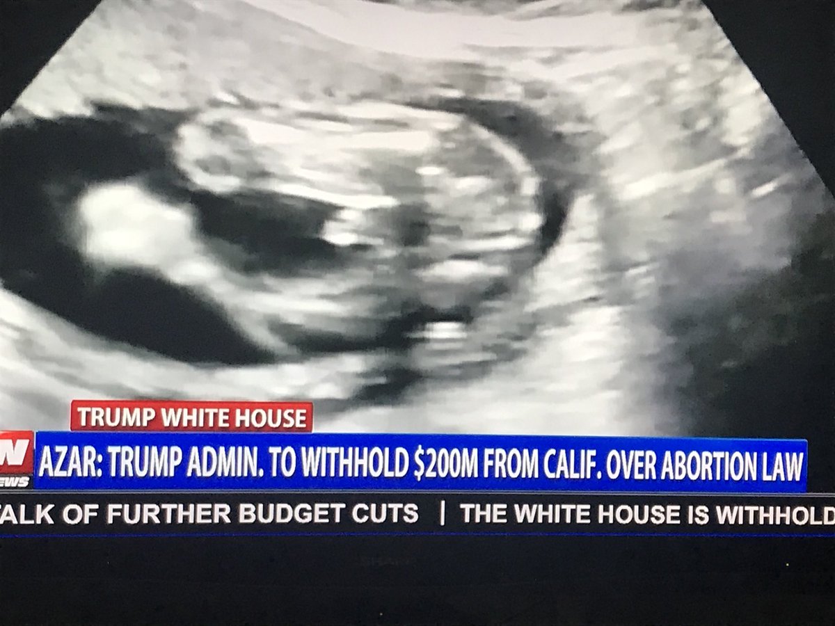 dutchsheets's tweet photo. Trump withholding $200m per quarter from CA for funding abortions. To those who’ve given up the election fight-this policy will end under Biden, as will “the Mexico law”, which gives millions internationally for abortions. Fight for the babies. Be their voice. https://t.co/Qwv5QluE1e
