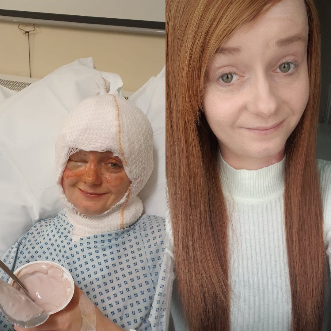 Queen Victoria Hospital NHS Foundation Trust tweet media