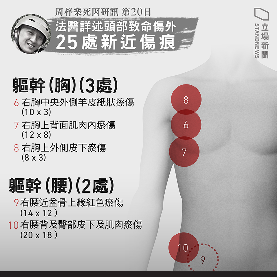 KS_Y2019's tweet photo. 俾人拳打腳踢?!

#hkpoliceterrorists 
#HKPolice 
#周梓樂死因研訊 https://t.co/hSHl5lhb6z