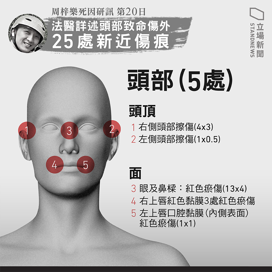KS_Y2019's tweet photo. 俾人拳打腳踢?!

#hkpoliceterrorists 
#HKPolice 
#周梓樂死因研訊 https://t.co/hSHl5lhb6z