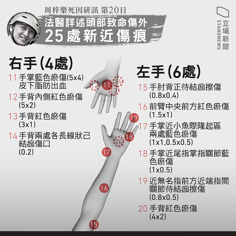 KS_Y2019's tweet photo. 俾人拳打腳踢?!

#hkpoliceterrorists 
#HKPolice 
#周梓樂死因研訊 https://t.co/hSHl5lhb6z
