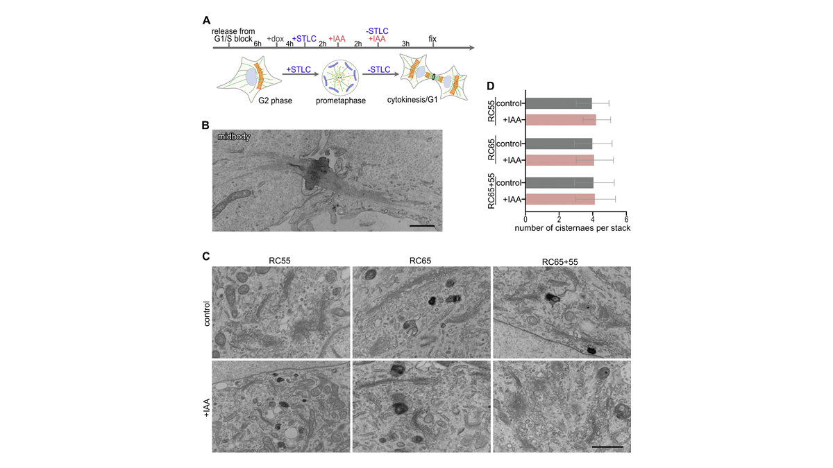 JCellBiol's tweet photo. Rapid degradation of GRASP55 and GRASP65 reveals their immediate impact on #Golgi structure, say Yijun Zhang and Joachim Seemann @UTSWNews: https://t.co/zRsIlhKskX
#Organelles https://t.co/I6JnaB3jMf