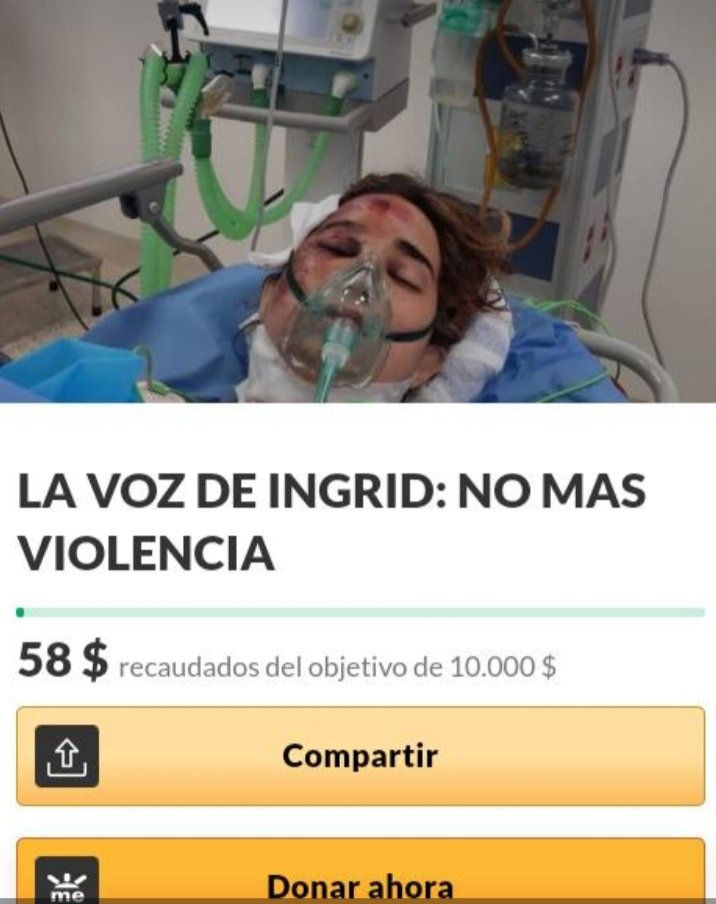 ligiaM_77's tweet photo. Esta joven es compañera de universidad de mi hija en estudios de Comunicación social. 
Fue agredida por su ex-novio.
Se debate su vida en el hospital Miguel Pérez Carreño.
Necesita ser traslada de urgencia, un RT para que su caso se resuelva.
#17DeDiciembre 
@LucyPN https://t.co/okkVexjjBG