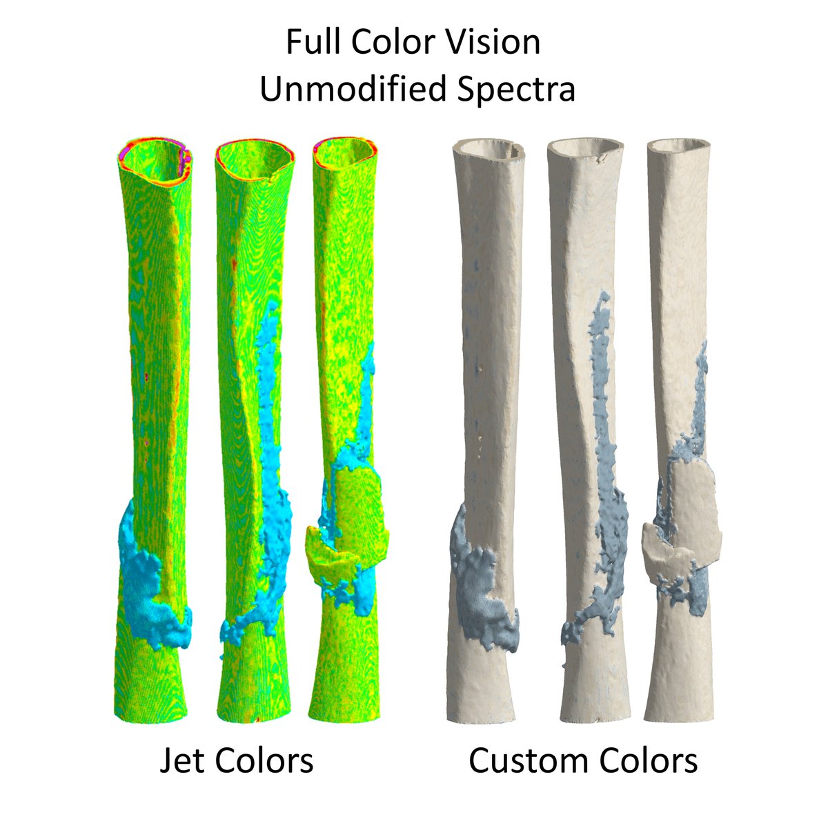 These models of human tibial fractures by  @P_Schwarzenberg were reconstructed from CT scans. Color scales show tissue density. Jet reveals the callus, but is not visually appealing with colorblindness. The new colormap is more pleasing and intuitive, even in grayscale.
