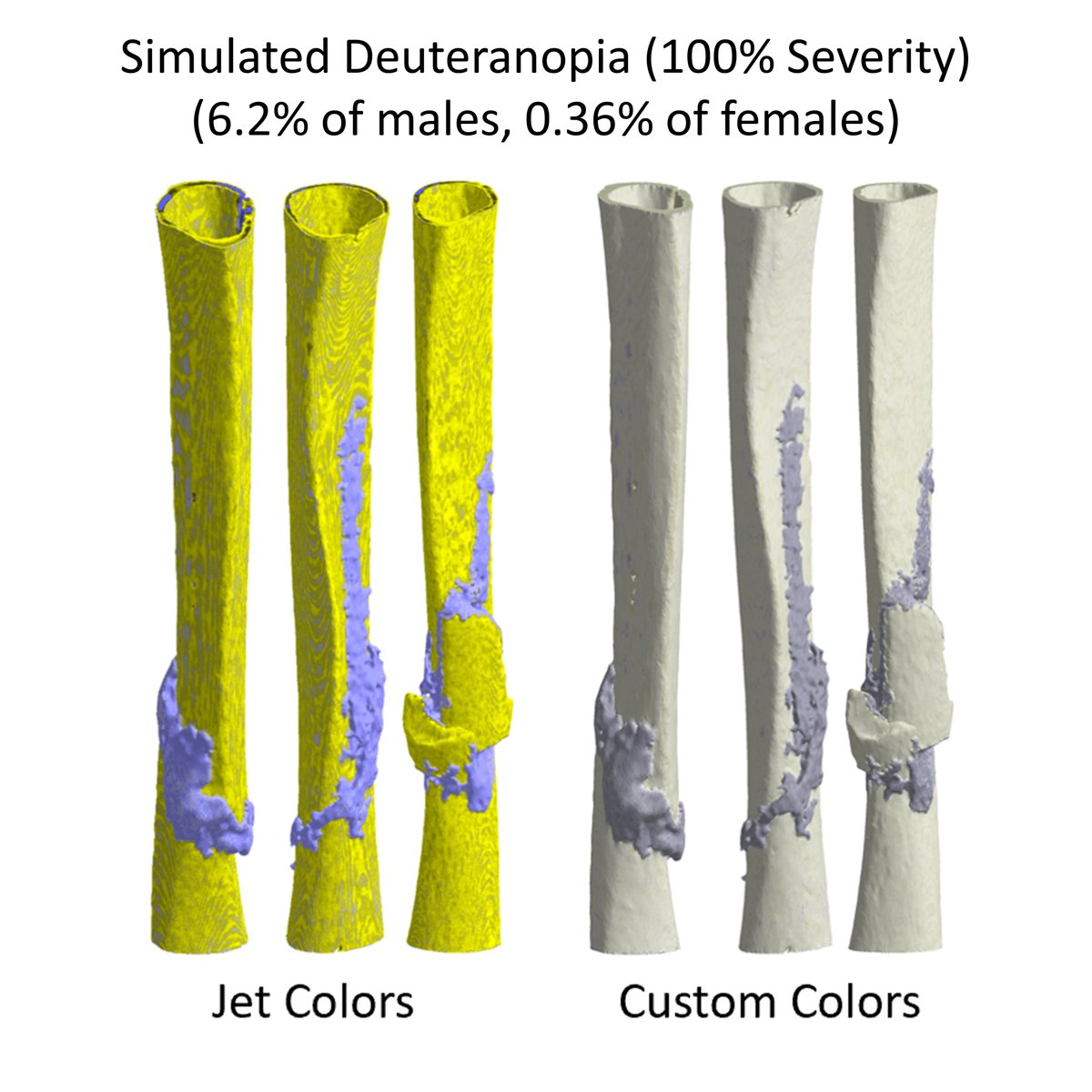 These models of human tibial fractures by  @P_Schwarzenberg were reconstructed from CT scans. Color scales show tissue density. Jet reveals the callus, but is not visually appealing with colorblindness. The new colormap is more pleasing and intuitive, even in grayscale.