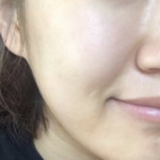 _Beauty_s's tweet photo. กลับจากดำน้ำ หน้าไหม้จนแสบ จมูกลอกผดก็ขึ้น โบกตัวนี้ไป7วันเองมึงง หน้าดีขึ้น ผดหาย ไม่แสบ ไม่ลอกแล้ว หน้ากับมาใสเหมือนเดิมเว้ย #ไว้รีวิวห้ามขายของโว้ยยย #ใช้ดีบอกต่อ https://t.co/GMzexvTKbI