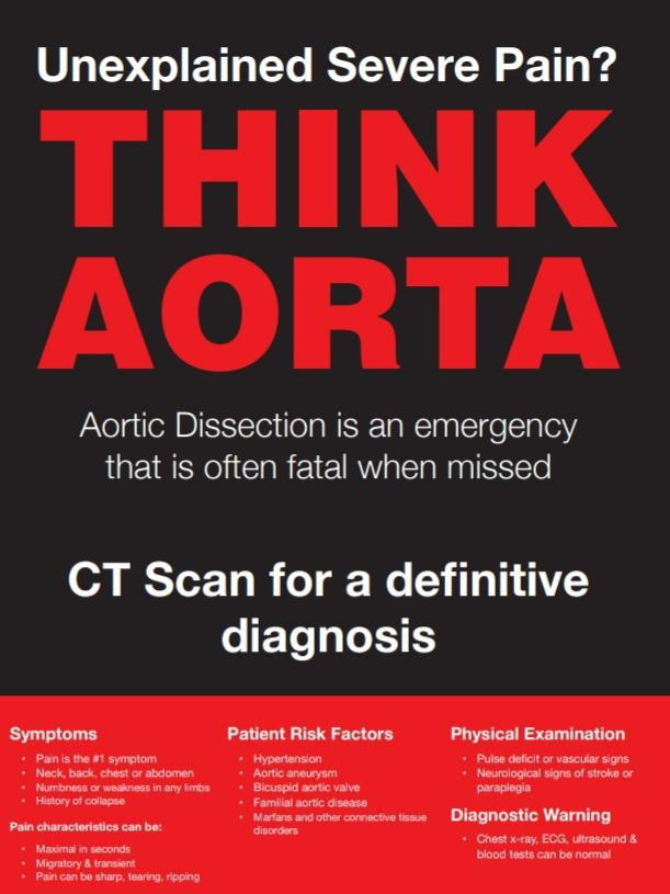 ed_tuh's tweet photo. TUH EM &amp; Radiology #simulation training on thoracic dissection. THINK AORTA. Pain is sudden in onset, severe and may be migratory. #communication is crucial. Urgent CT Angiogram makes the diagnosis. Thanks to all the TUH team #sharedlearning #teamwork #CRM #TUHworkingtogether https://t.co/VwZ2fbb3hF
