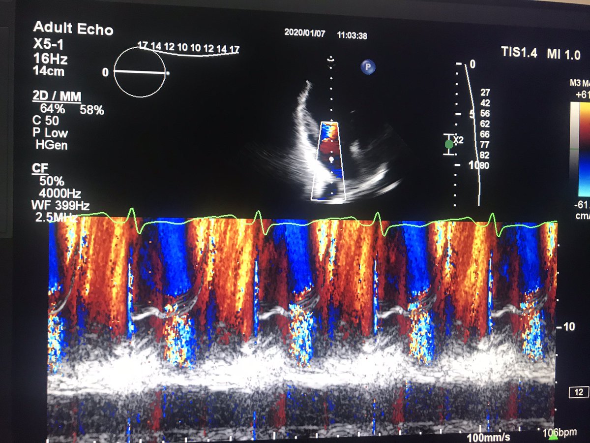 ShawnMasoumi's tweet photo. This is the result when a cardiologist draws #cardiotwitter #cardioart #Cardiology https://t.co/zGdIf3eJu2