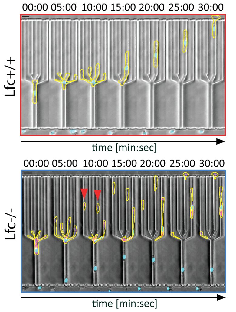 JCellBiol's tweet photo. Kopf @aglaja_k, Kiermaier, Sixt et al. demonstrate that #microtubules help migrating cells keep their shape (https://t.co/y7iAZUgBwM). Part of the Year in Cell Biology 2020 collection: https://t.co/eQjiOpSlNh
#cellbio2020 https://t.co/WrZUEAvOp5