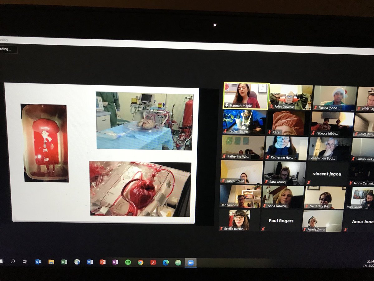 BrightonNerd's tweet photo. It’s possible to keep organs alive for longer through “normothermic perfusion” during transit from donor to recipient. The next big thing in organ transplantation #nerdnitebrighton ⁦@TransplantMaple⁩ https://t.co/aHhzin2bW8