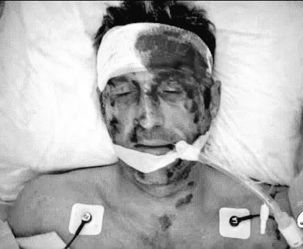 dempeogreyshep's tweet photo. it hurts. so damn much. #GreysAnatomy https://t.co/g6iY1vDZnS