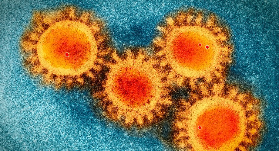 “Corona” in coronavirus means crown in Latin. It describes the proteins sticking out on the outer fat membrane that makes the virus look like it’s wearing a crown of spikes. In fact, these are called spike proteins and they bind to the ACE2 receptors found in many lung cells.