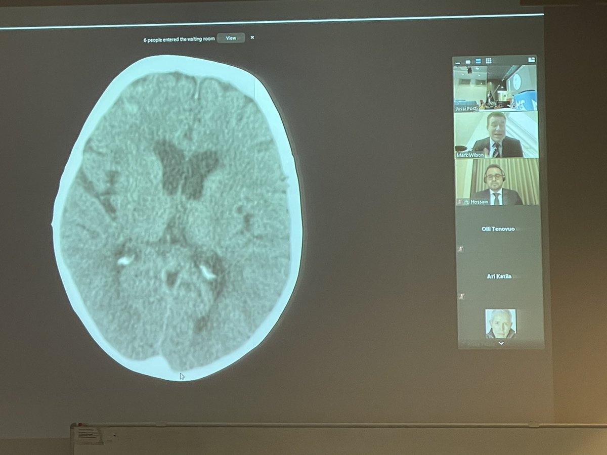 New-age doctoral dissertation on TBI going on at Turku Neurosurgery: doctoral candidate in Dhaka, opponent in London and custos in Raisio, Finland. Global audience, from Capetown to Turku. One way to beat Covid!