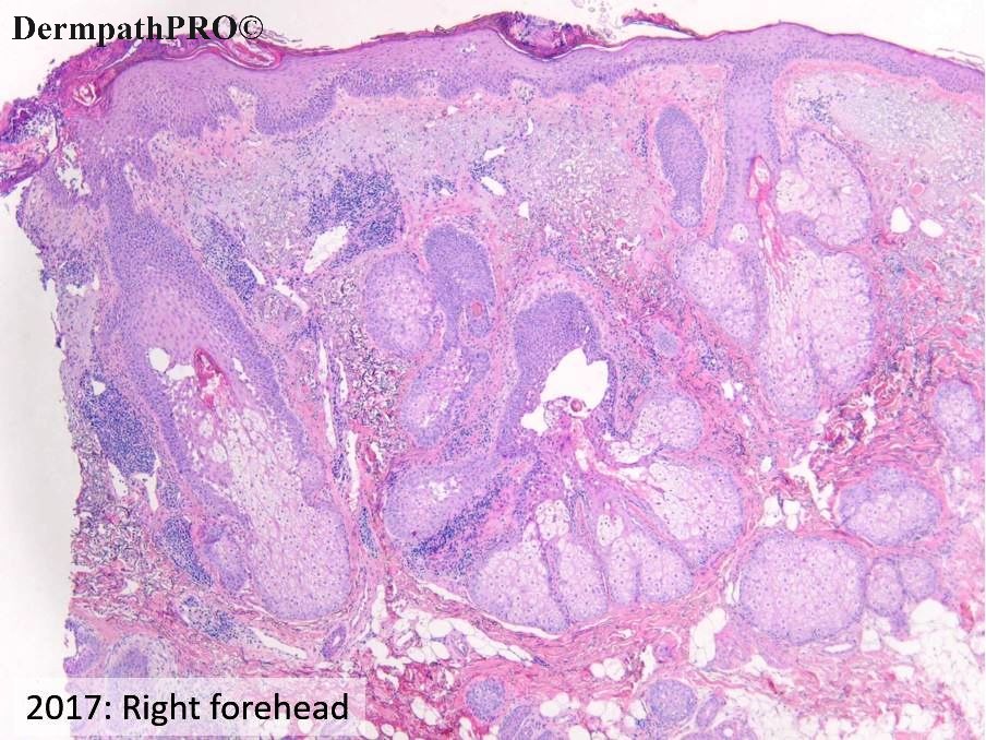 DermpathPRO tweet media