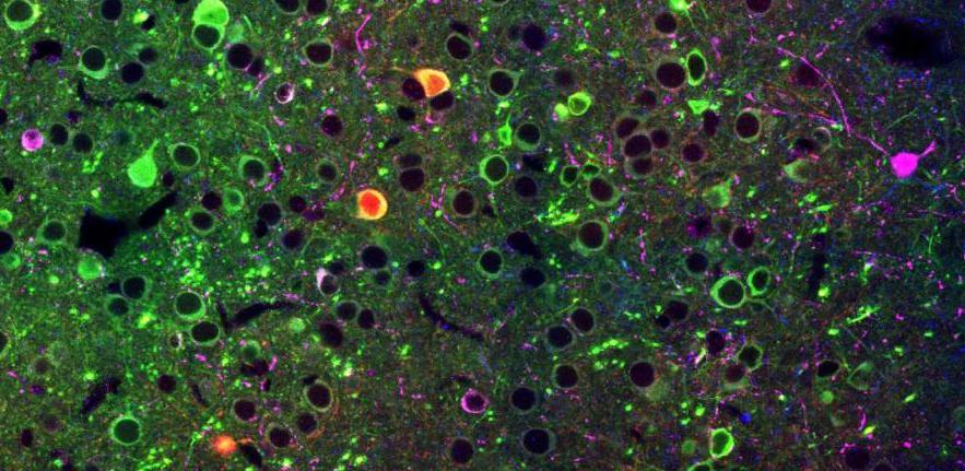 Jasper Poort (@jasper_poort) on Twitter photo Looking for postdoc or research assistant to study neural mechanisms of visually-guided learning and decision-making! Join our lab pdn.cam.ac.uk/svl/ at <a href="/PDN_Cambridge/">PDN Cambridge</a>: jobs.cam.ac.uk/job/28128/ contact me for informal enquiries Looking for postdoc or research assistant to study neural mechanisms of visually-guided learning and decision-making! Join our lab pdn.cam.ac.uk/svl/ at <a href="/PDN_Cambridge/">PDN Cambridge</a>: jobs.cam.ac.uk/job/28128/ contact me for informal enquiries