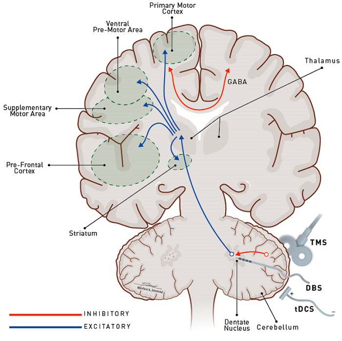 BrainSci_MDPI's tweet photo. #mdpibrainsci Little Brain, Big Expectations https://t.co/XIW1dsUU3G #cerebellum #dystonia #neuromodulation #Parkinson https://t.co/ErjF8sPcm2