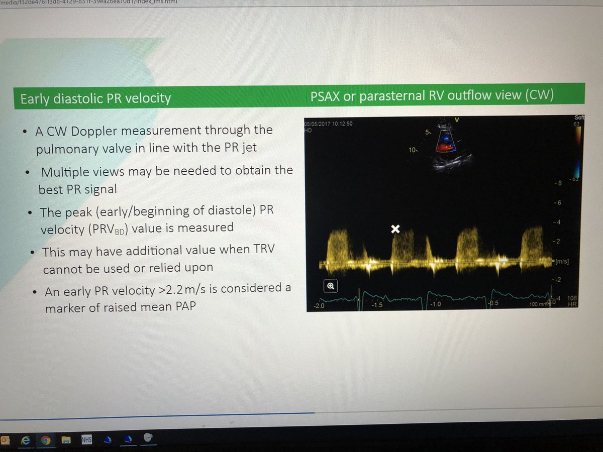 Beckster2018's tweet image. Pulmonary hypertension e-learning module from @BSEcho available to all BSE members F.O.C courtesy of an education grant from the @TheBHF @BHFprofessional : some lunch time learning with thanks 🙏🏻