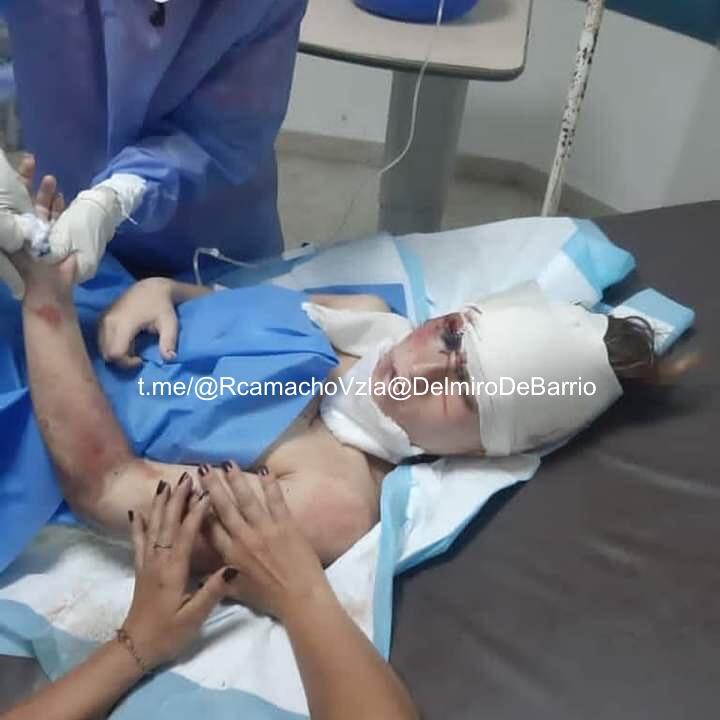 Así luce la violencia en contra de la mujer. José Luis Da Silva Fernandez, de 21 años de edad, golpeó, apuñaló en el cuello con una botella y arrastró de su vehículo a Ingrid Gomes, estudiante de comunicación social de la USM, el pasado #14dic en El Junquito. Ellos habían sido