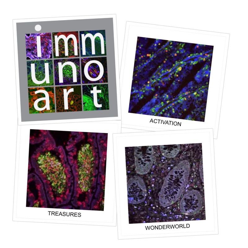 Lupprians's tweet photo. Please visit Immuno Art website, purchase art &amp; help #CANCER research: 

https://t.co/cpVXQ0JDLz

#BreakCancer #adcsm #blcsm #gyncsm #lcsm #ancsm #btsm #hncsm #leusm #ayacsm #crcsm #hpbcsm #lymsm #bcsm #esocsm #kcsm #Leukaemia #Livestrong #ConquerCancer #Asco21 #EUCanBeatCancer https://t.co/5XcTsayVQ9