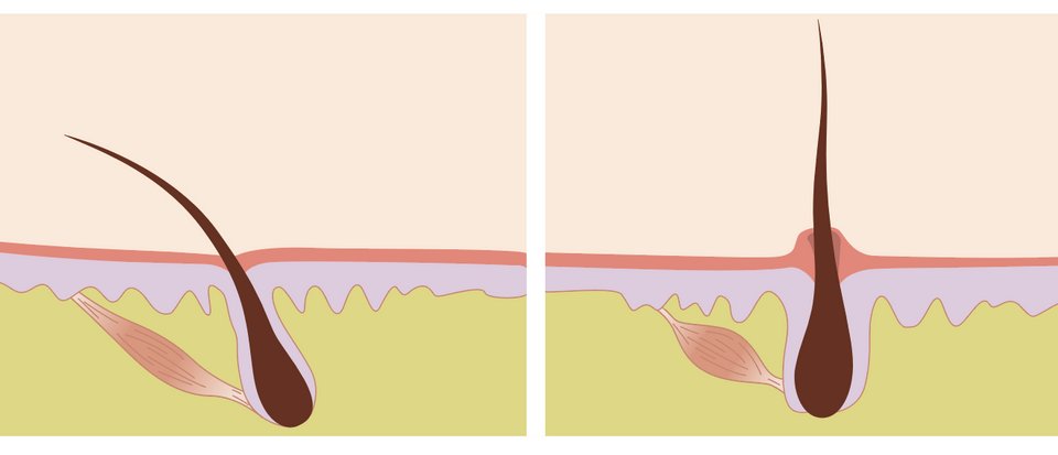 27. FUR or hair is similarly amazing, with similar properties (this photo is from a honeybee).Fur is less structural and has a more dynamic relationship with thermal regulation. For example, one of the reasons it stands on end is to increase the rate of evaporation.