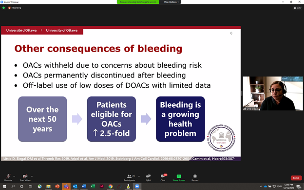 uOttawaIGHOMed's tweet photo. LIVE NOW: Dr. Deborah Siegal, @DebSiegal, on the consequences of bleeding: "Over the next 50 years, with the number of patients eligible for anticoagulants increasing, bleeding will continue to be a major health problem".
#thrombosis #MedtTwitter #MedEd #MedEdChat https://t.co/qHTEHjt8HM