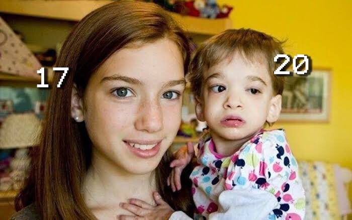westtrybe's tweet photo. There was only one person in the world with “Syndrome X” which prevents normal aging. Brooke Greenberg is 20 and appears to be 1 year old.

#MythAndFact https://t.co/KYH3fEf0CA