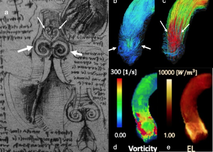 RadiolMed's tweet photo. Editor's Pick: Cardiac Radiology/
4D Flow when and how?
https://t.co/pLGij5jThU
#radiology @NagoyaUniv @ClinMedJournals https://t.co/4gIcqcLDXZ