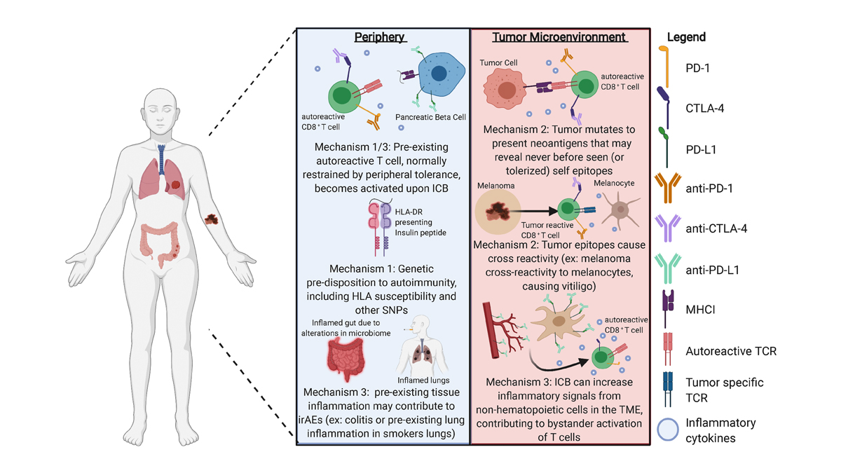 RockUPress's tweet photo. In @JExpMed #JEMCancerFocus, @burkekelly1, @Vignali_Lab et al. discuss several hypotheses regarding the underlying mechanisms of immune-related adverse events in #immunotherapy, the testing of which may improve #cancer patient outcomes. https://t.co/VJfSRN2PFn https://t.co/hEiehF66W0