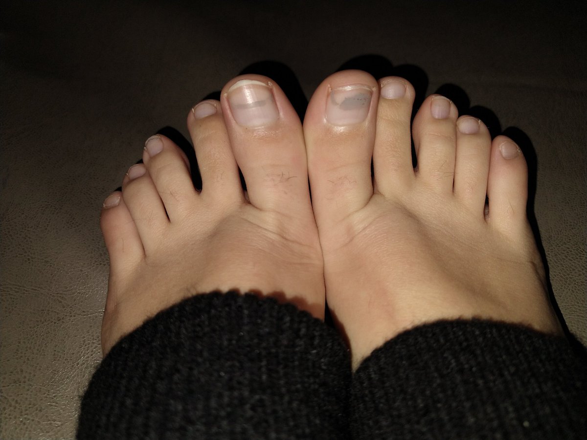 RsGld4's tweet photo. Where are all my feet lovers 😍 https://t.co/RlGrG7WCA1