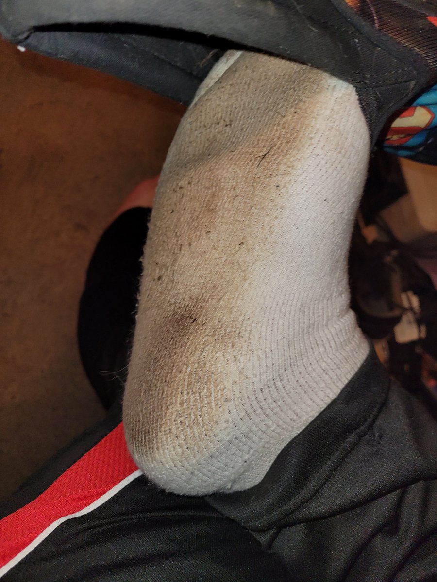 mistertoejam's tweet photo. Look at the color on these bad boys need someone to sniff these hard!!! #footfetish #feetfetish #malefeet #guyfeet #stinkyfeet #stinkysocks #sweatyfeet #smellyfeet #wornsocks #malefootfetish #alphafeet #dirtyfeet #dirtysocks #footstink #footsniffing https://t.co/K5hRhfi2vq