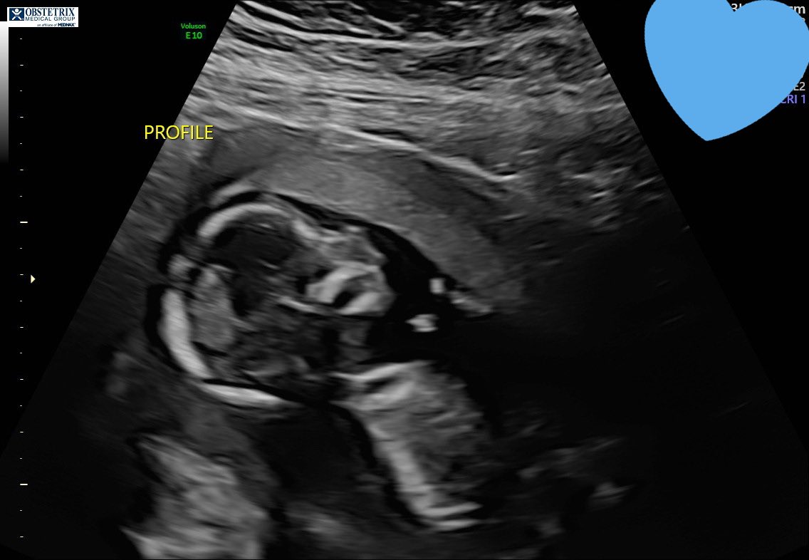 chloeee001_'s tweet photo. Mateo Javier Contreras 💙 Our little gift from God. We can’t wait to meet you! https://t.co/wDQVALDJdG