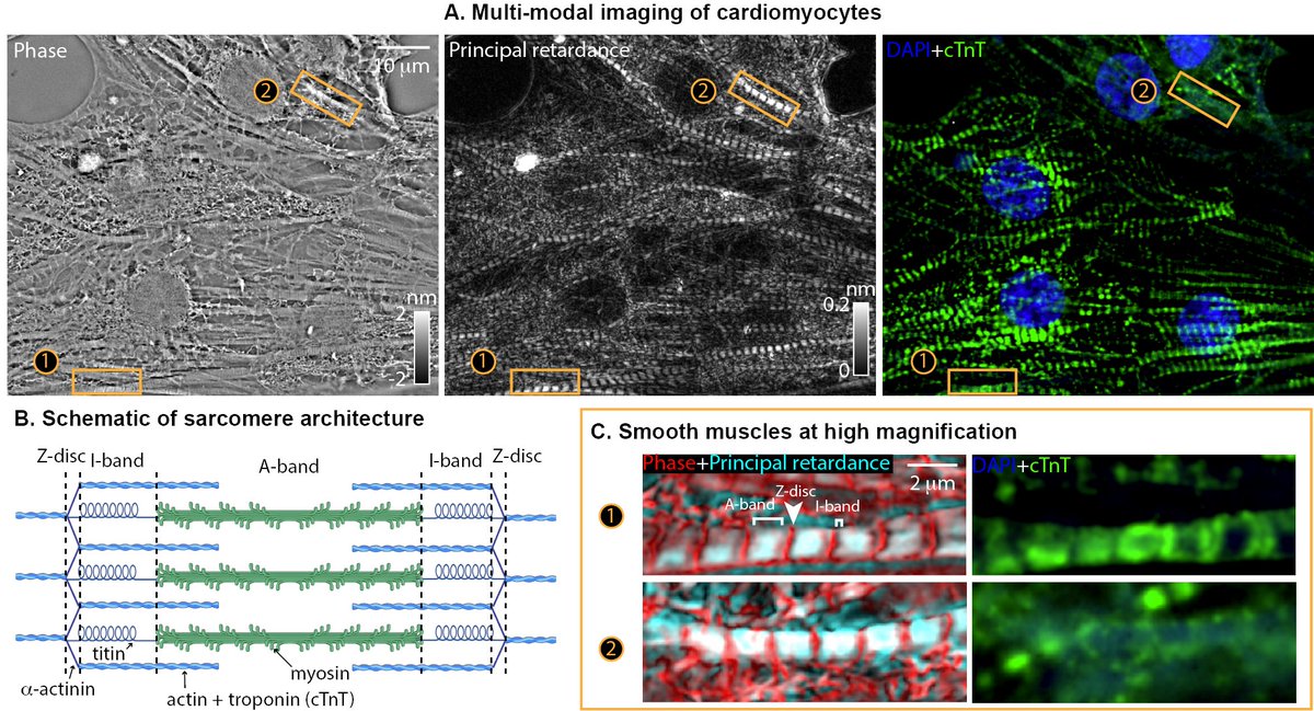 uPTI is a module that is easily added to a widefield fluorescence microscope. Multiplexed imaging of iPSC-derived cardiomyoctes with uPTI/fluor deconvolution shows their rich architecture- myofibrils, bands of sarcomere, troponin bands, nuclei, membranous organelles, … (9/n)