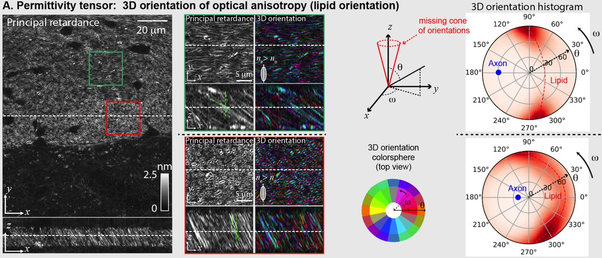  @LiHao_Yeh and I also understood the effect of "missing cone of orientations” in angular dimensions during an intense brainstorm. The effect is analogous to the “missing cone of spatial frequencies” in spatial dimensions in single-view fluorescence microscopes. (14/n)