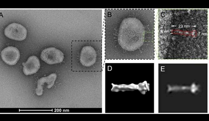 diariohoynet's tweet photo. 🦠 #Covid19 | #Coronavirus | #NegativeStain | #CryoEM | #bioXiv
La verdadera cara del Coronavirus
Así se ve el SARS-CoV-2 bajo el microscopio.
https://t.co/c6nbKDcBIJ https://t.co/hQhUrYlYbC