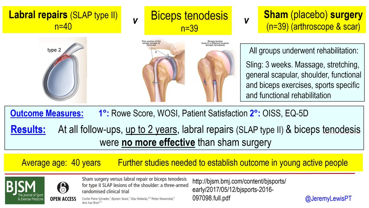 JeremyLewisPT's tweet image. The bigger question is....does it matter?
SLAP type II v biceps tenodesis v sham
Same outcome in cohort mean age 40 years
#placebo #notsustainable #toomuchmedicine #wastedresources
let's emerge from the pandemic and think again!
