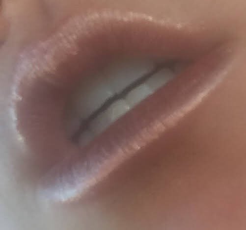 Miss_MD86's tweet photo. #invisalign made this #Smile #dentalart #whiteteeth https://t.co/MnKzOrkM90