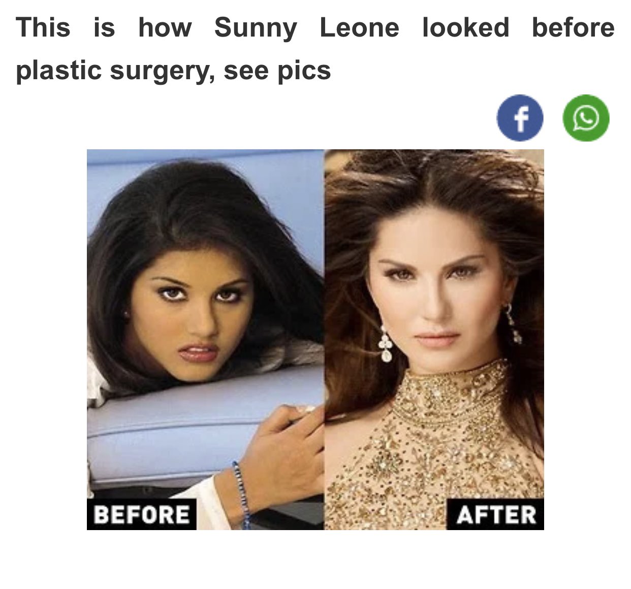 sunny plastic surgery