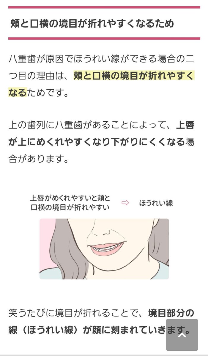 あるちゃん 歯列矯正でほうれい線 尾翼基部陥没 が改善するパターン 悪化するパターン 改善しやすい人 口ゴボが原因で境目が 盛り上がって相対的に鼻が下がって陥没している人 抜歯しすぎて引っ込めすぎるのもだめなので適切な判断のできる医師が必要っ
