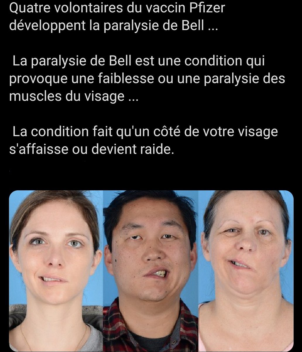 DocAmine_'s tweet photo. ⚠️ Cette information est trompeuse, je vous explique pourquoi :

4 volontaires sur les 22 000 personnes qui ont participé aux essais cliniques ont effectivement présenté une paralysie de Bell.
Alors pourquoi est-ce que les experts ne jugent-ils pas cela inquiétant ?
1/4 https://t.co/CsCkfMMNsx