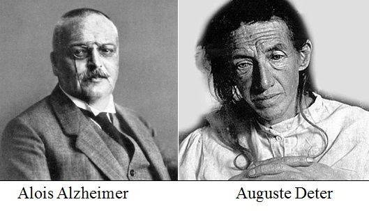 Dr. Alois #Alzheimer died #OTD 105 years ago at the age of 51. He first described in 1906 a patient suffering from the #syndrome that now bears his name.

#Neurology #Psichiatria #histmed #storiadellamedicina #historiamedicina #medicine #medicina #doctors #historyofmedicine